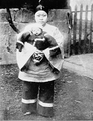 1902年，中国西南地区首例母子平安的剖宫产在医院平安诞生_Jc